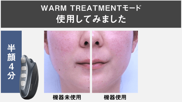  WARM TREATMENTモード（ウォームトリートメントモード）の効果