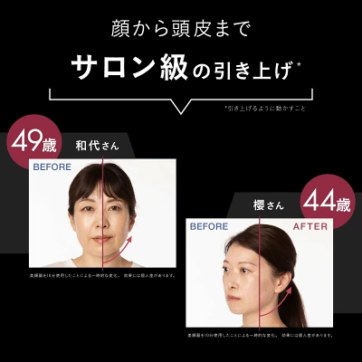 エレキブラシプラスの特長