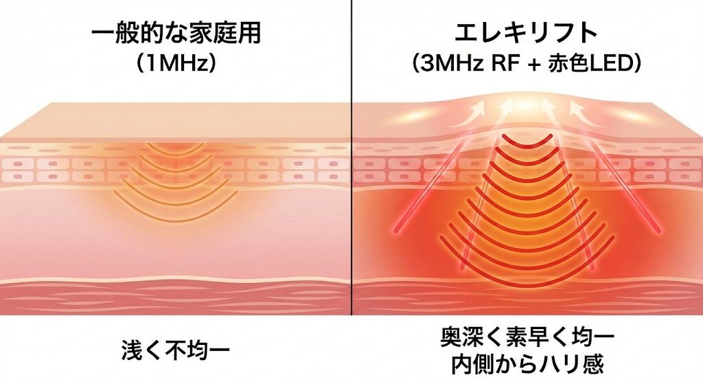 3-1. サロン級の高出力！3MHz RFと赤青LEDの実力